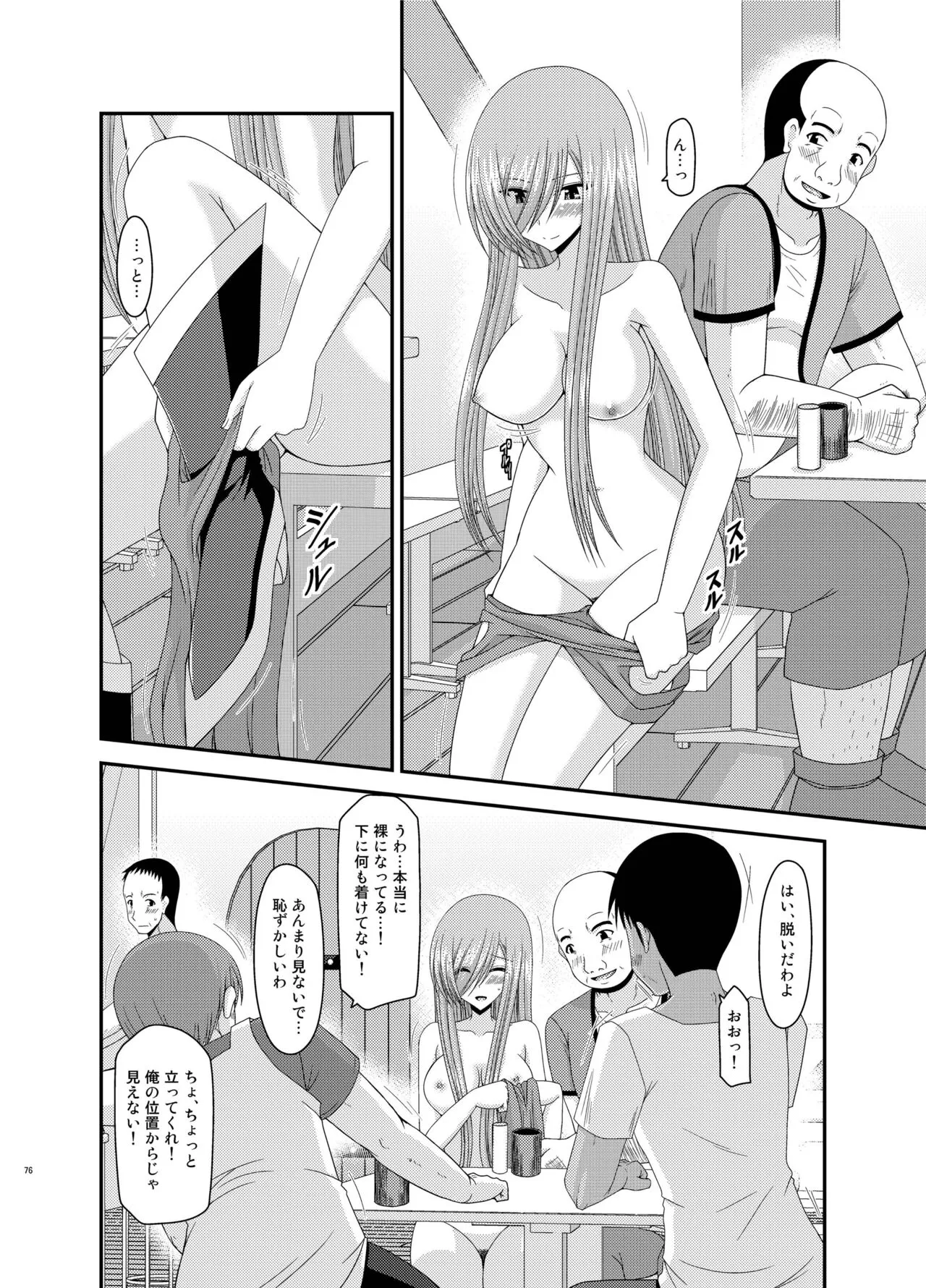 Melon ga Chou Shindou! R Soushuuhen III | Page 76